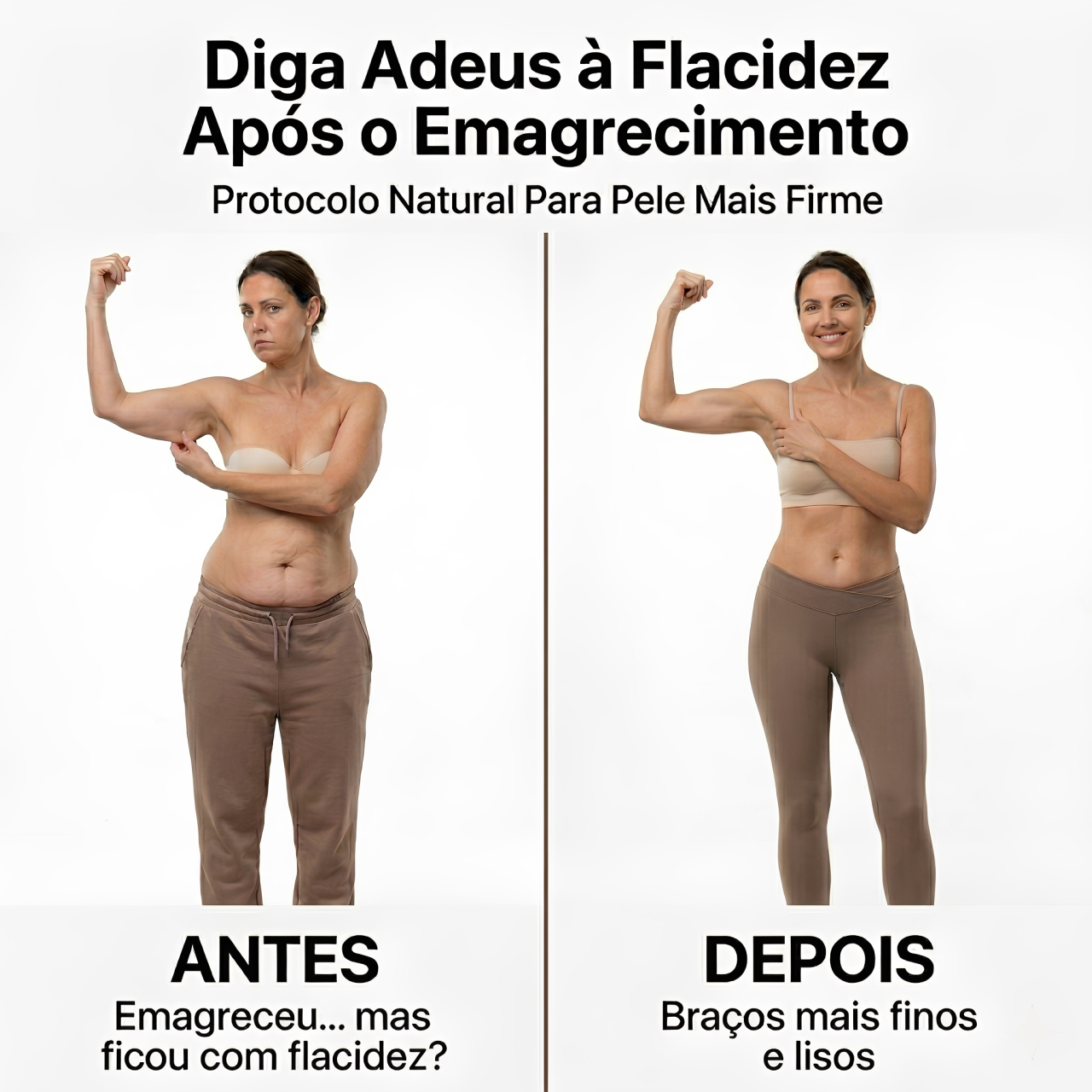 Antes e Depois da Flacidez